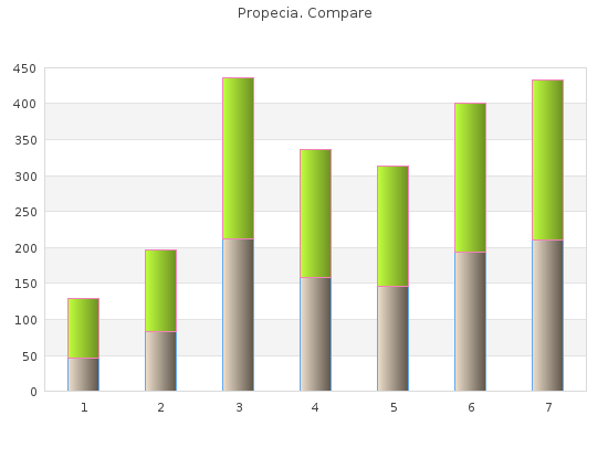 discount propecia 1mg without prescription